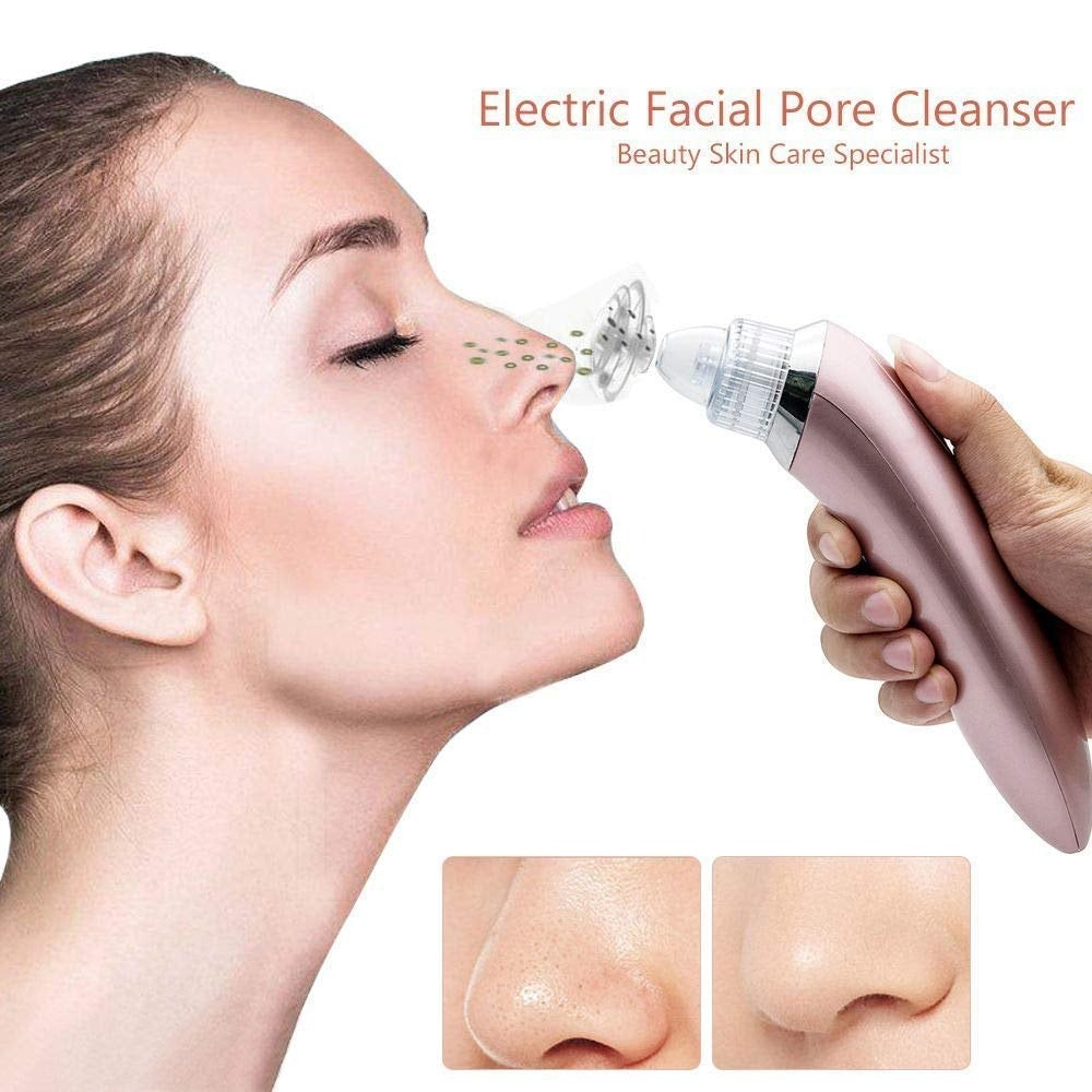 Derma Suction Pore Cleaning Device
