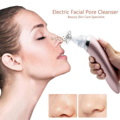 Derma Suction Pore Cleaning Device